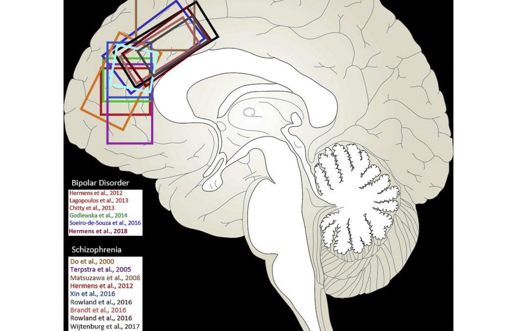 Antioxidant system in psychosis