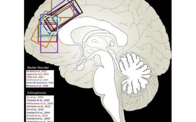 Antioxidant system in psychosis