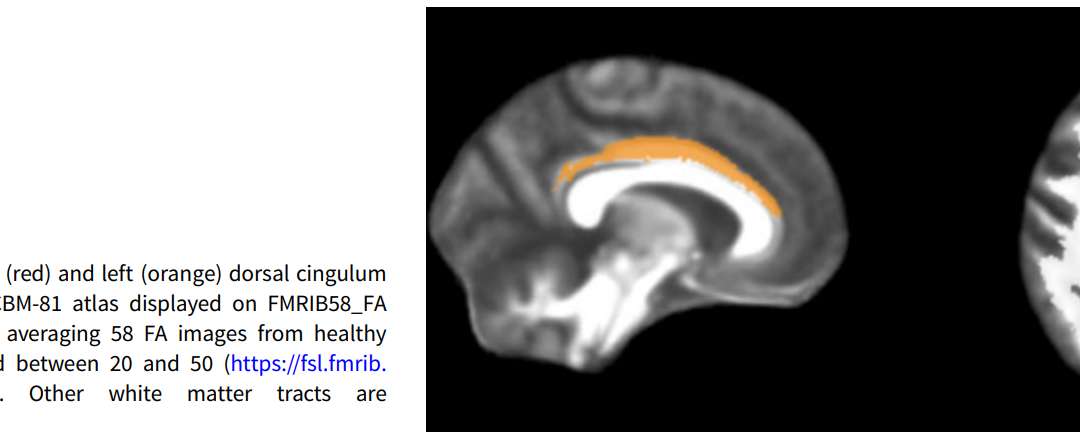 Myelin in Psychosis