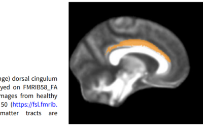 Myelin in Psychosis