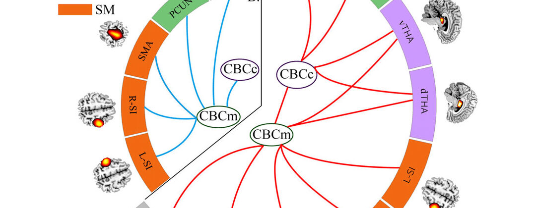 The Genetic Predisposition to Schizophrenia