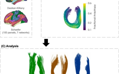 The small bent beams and bridges of our brain