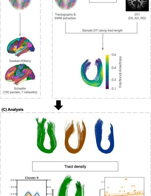 The small bent beams and bridges of our brain